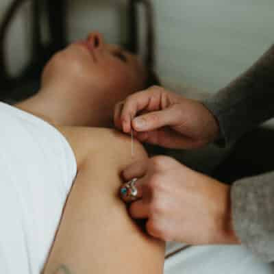Five Element Acupuncture
