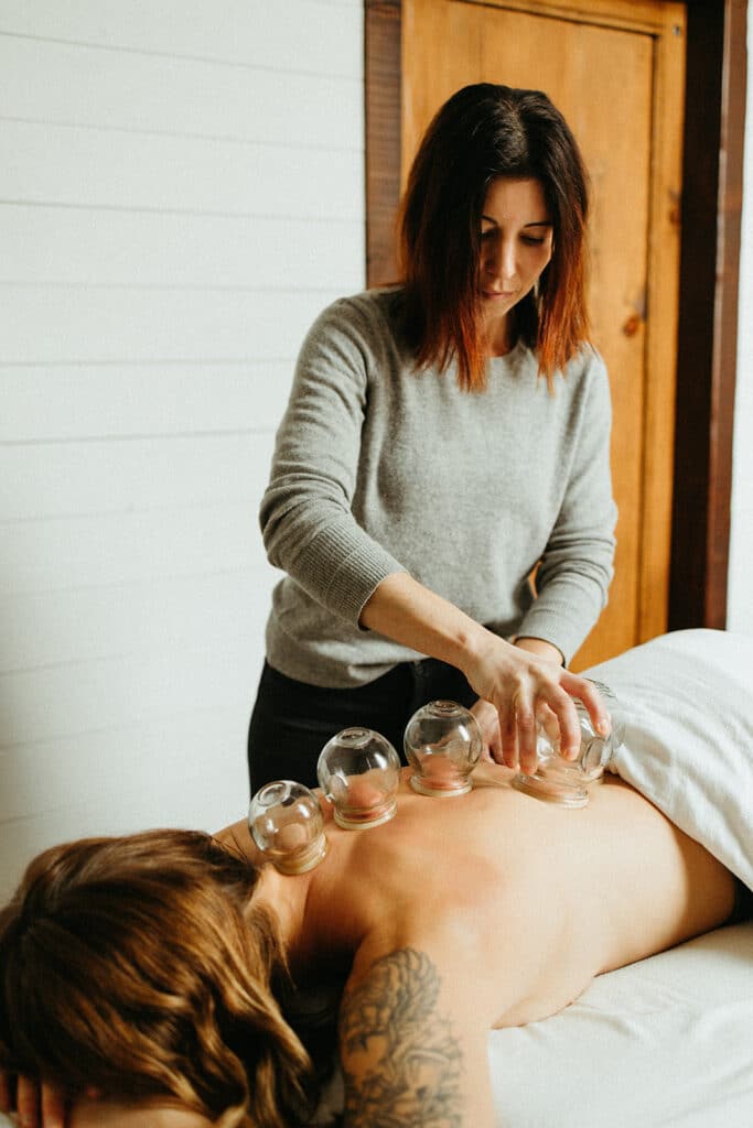 Acupuncture Image