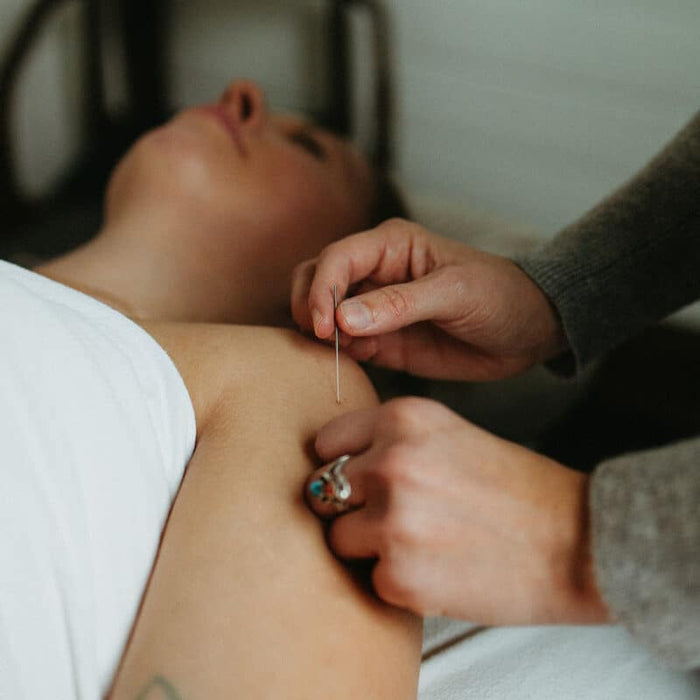Five Element Acupuncture