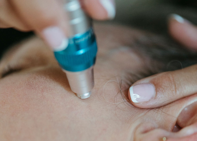 Microneedling
