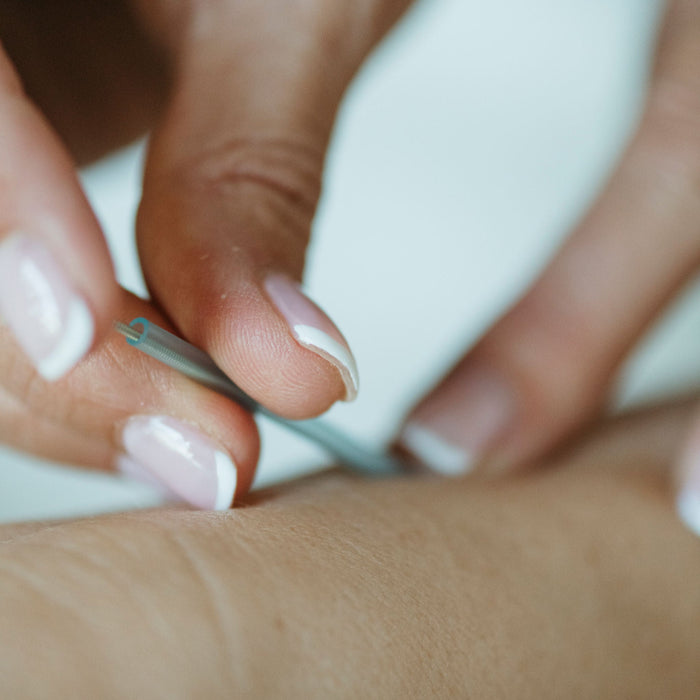 Five Element Acupuncture