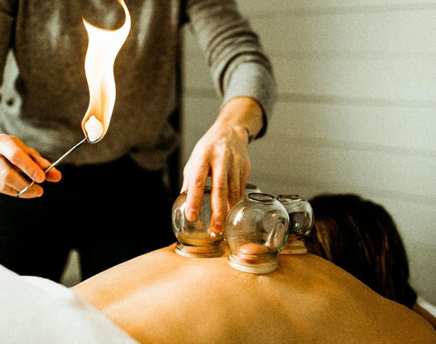 Cupping