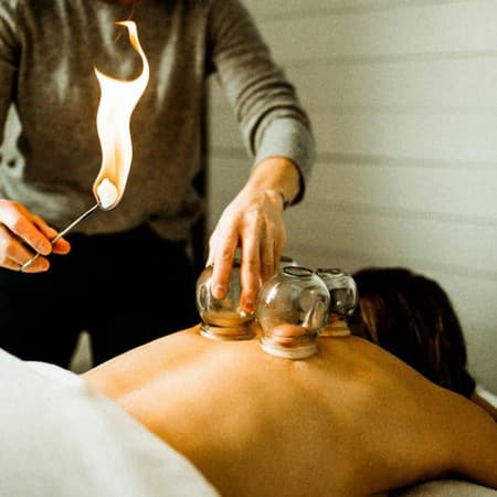 Cupping