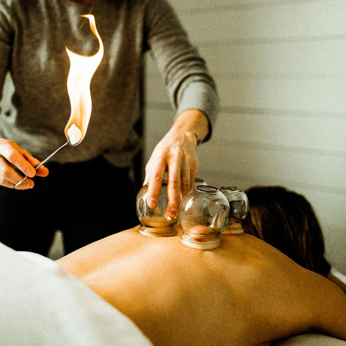 Cupping