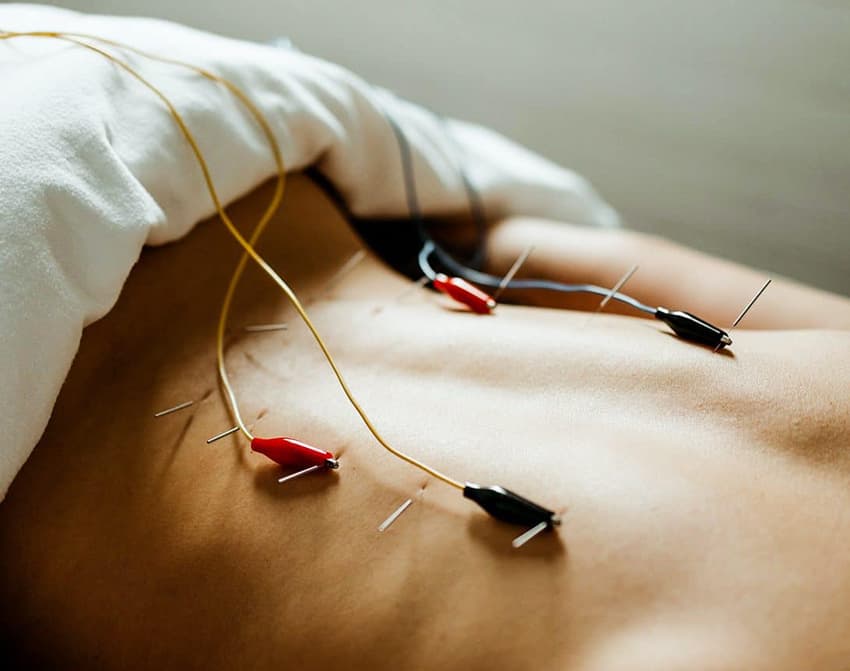 Electrical Stimulation