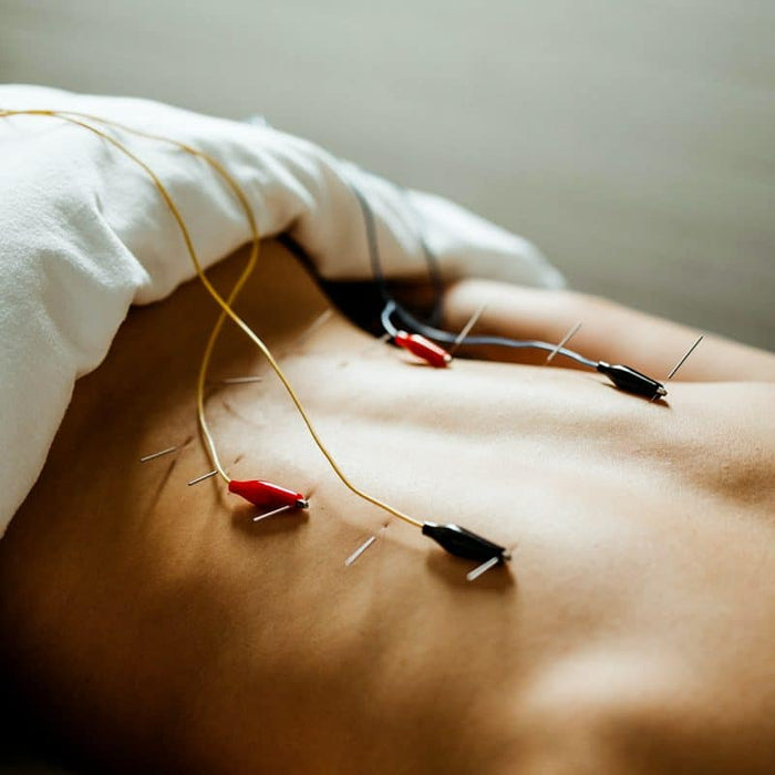Electrical Stimulation